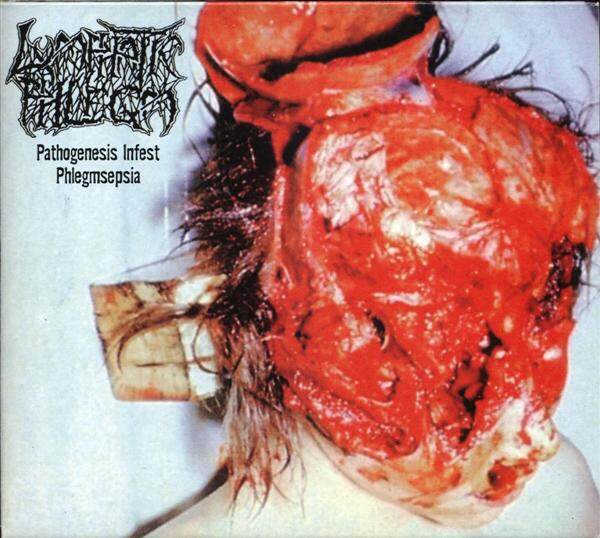 Lymphatic Phlegm《Gruesome Aftermath Of The Pathologists Cadaveric Vilipend》GTP谱