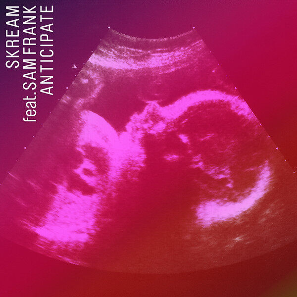 Skream《Anticipate》GTP谱